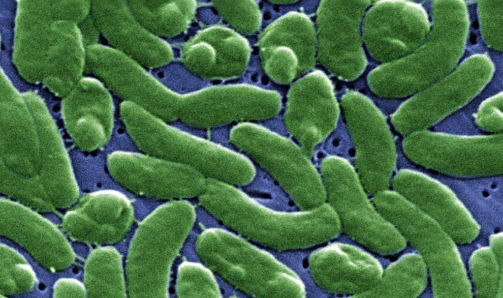 Flesh-eating bacteria off Louisiana coast leaves Gonzales man with months of surgeries, threat of amputation _lowres